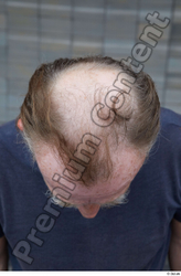 Head Hair Man White Casual Slim Bald Street photo references